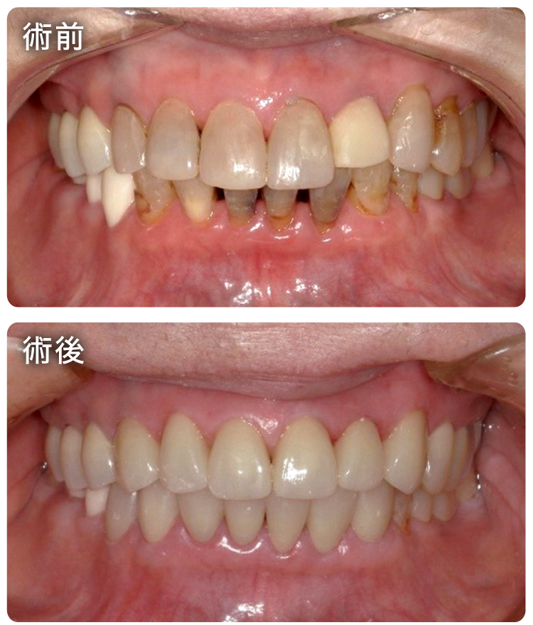 セラミック治療症例