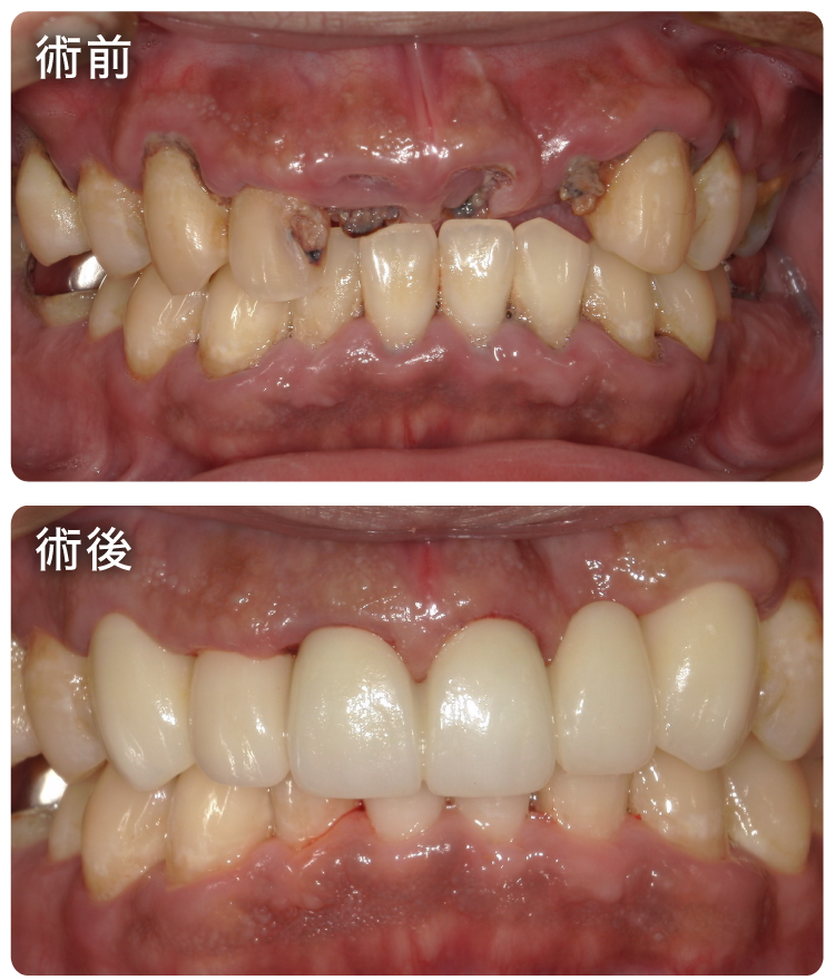 セラミック治療症例