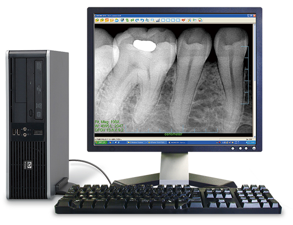 高性能歯科用コーンビームCT