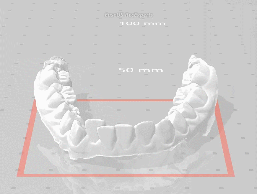 治療前の下顎模型（3D）動画