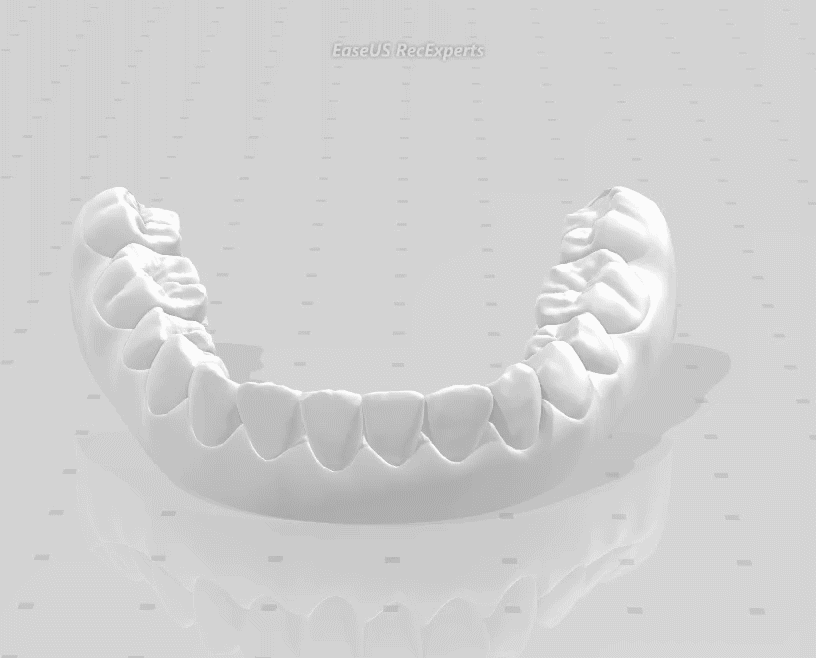 治療後の下顎模型（3D）動画