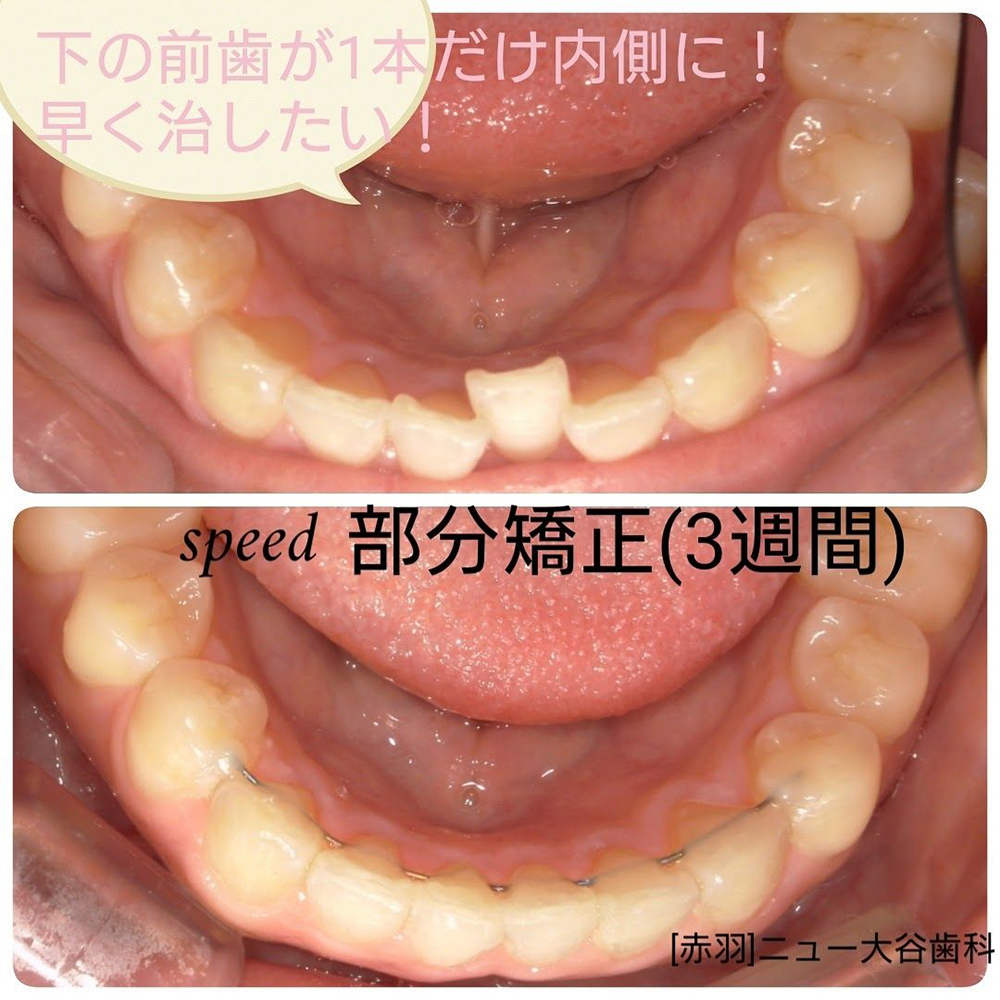 症例