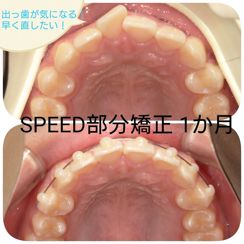 症例